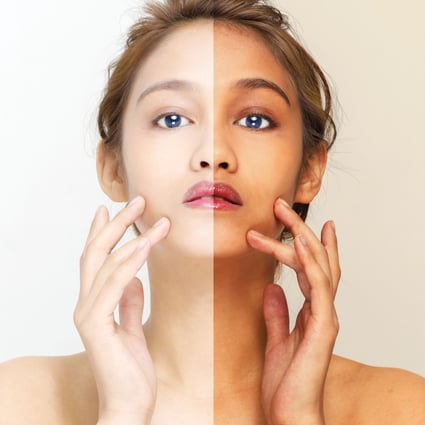 A World Health Organisation survey found that nearly 40 per cent of women polled in nations including China, Malaysia, the Philippines and South Korea said they regularly used whitening products. Photo: Shutterstock
