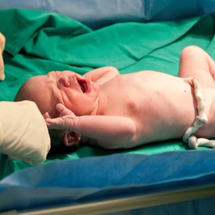 A newborn baby with the umbilical cord attached. Treatments derived from cord blood are booming – but unproven. Photo: Alamy