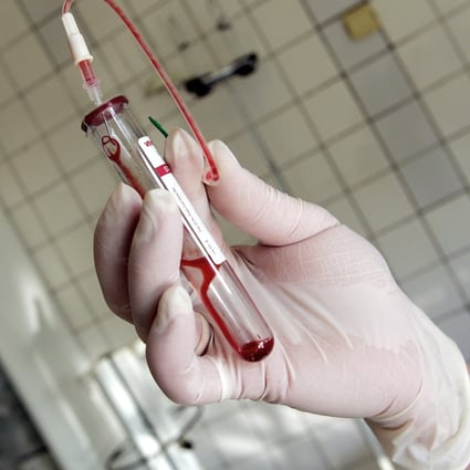 All Traces Of Hiv Vanish From London Patient In Second Such Case Raising Hopes Of Aids Cure South China Morning Post