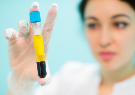 New blood tests developed in Hong Kong and the US deliver an easier, less invasive and more cost-effective way to detect Alzheimer’s disease early. Photo: Shutterstock