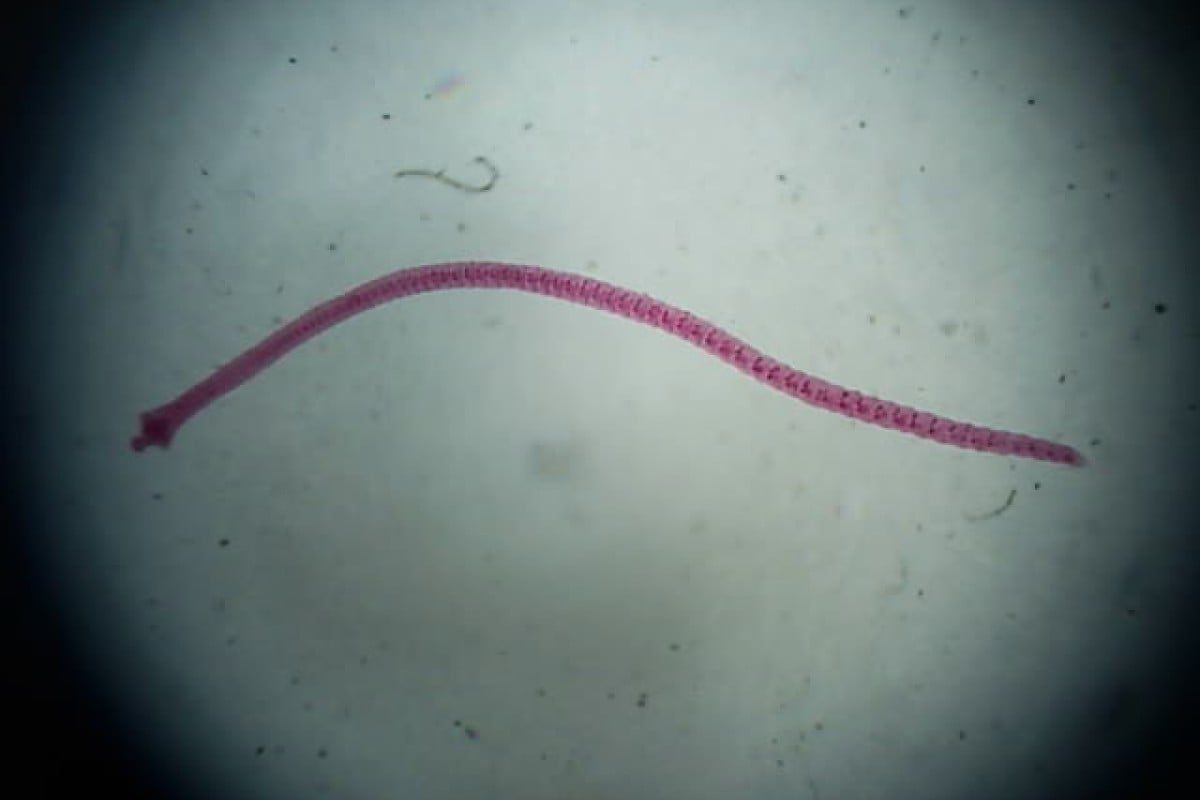 Лентовидный червь. Карликовый цепень (Hymenolepis Nana). Hymenolepis Nana – карликовый цепень-гименолепидоз. Класс ленточные черви карликовый цепень.